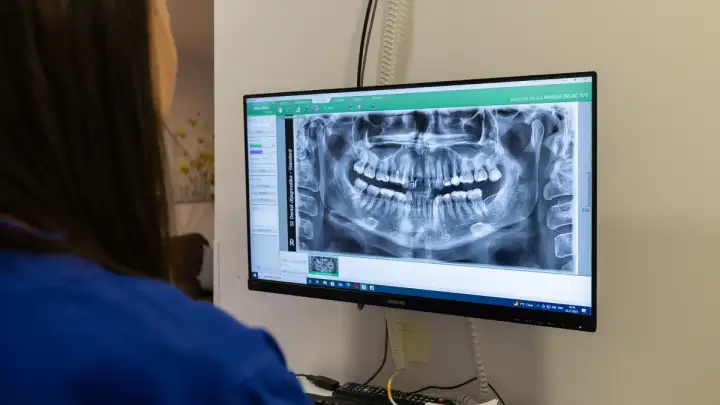 U SI Dentalu besplatni preventivni pregledi povodom Svjetskog dana oralnog zdravlja